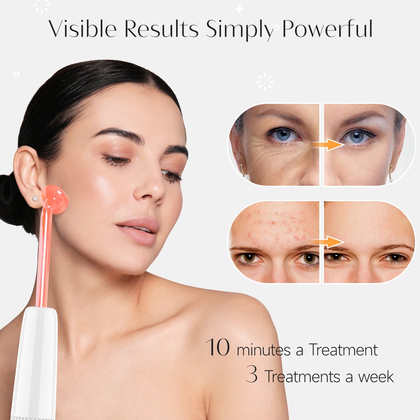 High-Frequency Facial Wand – The Ultimate Skin Rejuvenation Solution