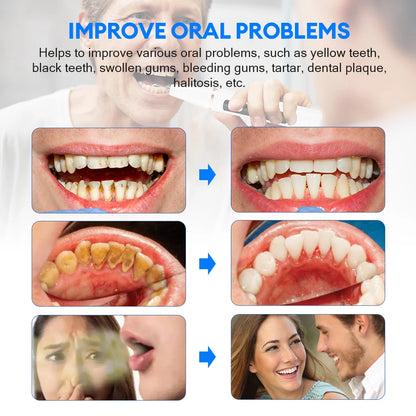 Ultrasonic Electric Teeth Cleaner – Tartar & Plaque Remover